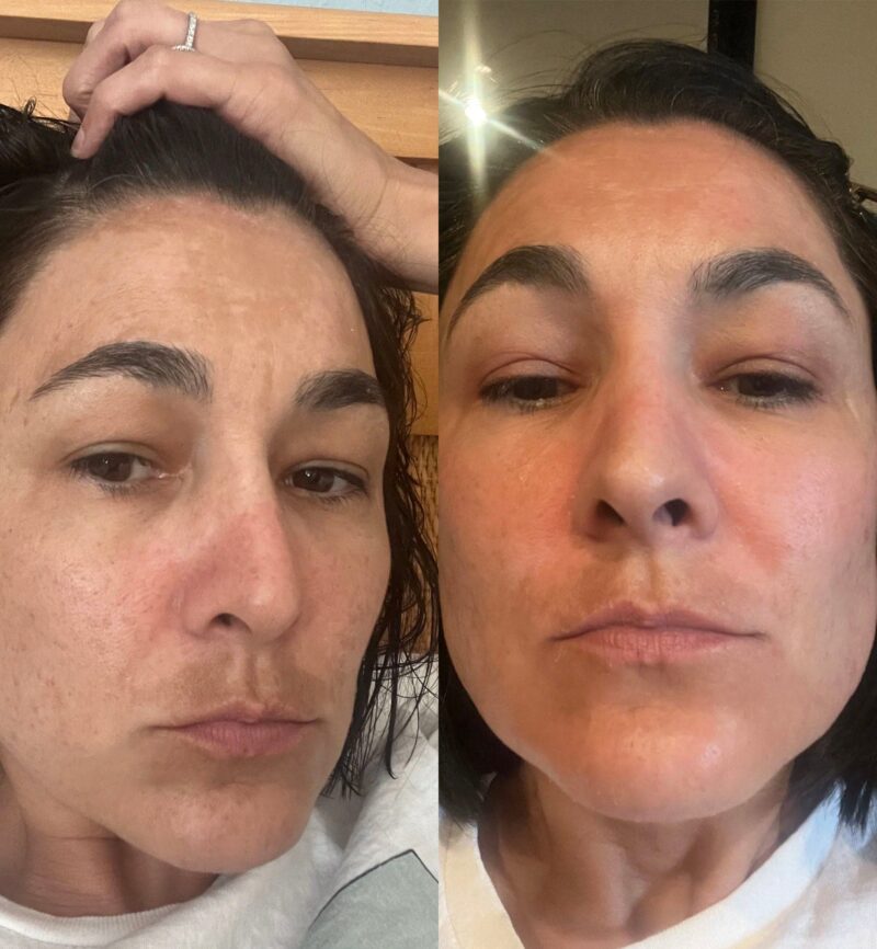 Advanced Brightening Kit - Image 8