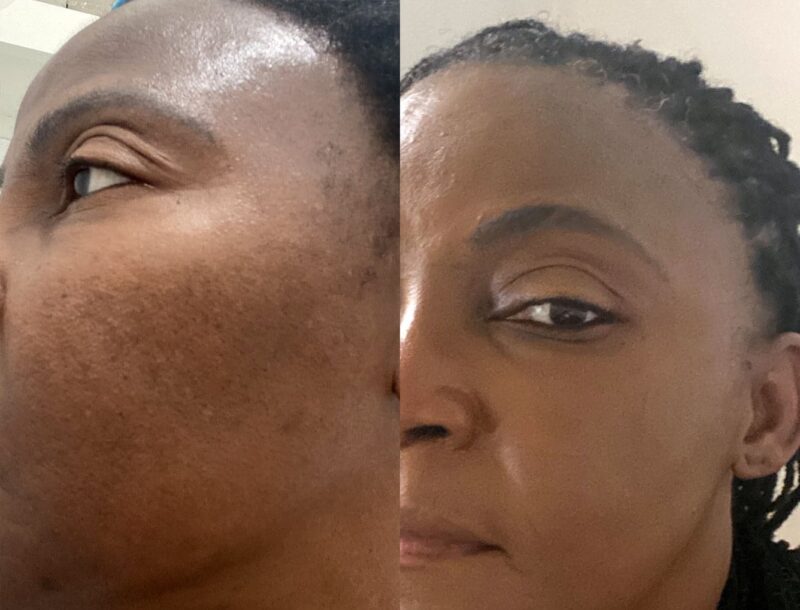 Advanced Brightening Kit - Image 9